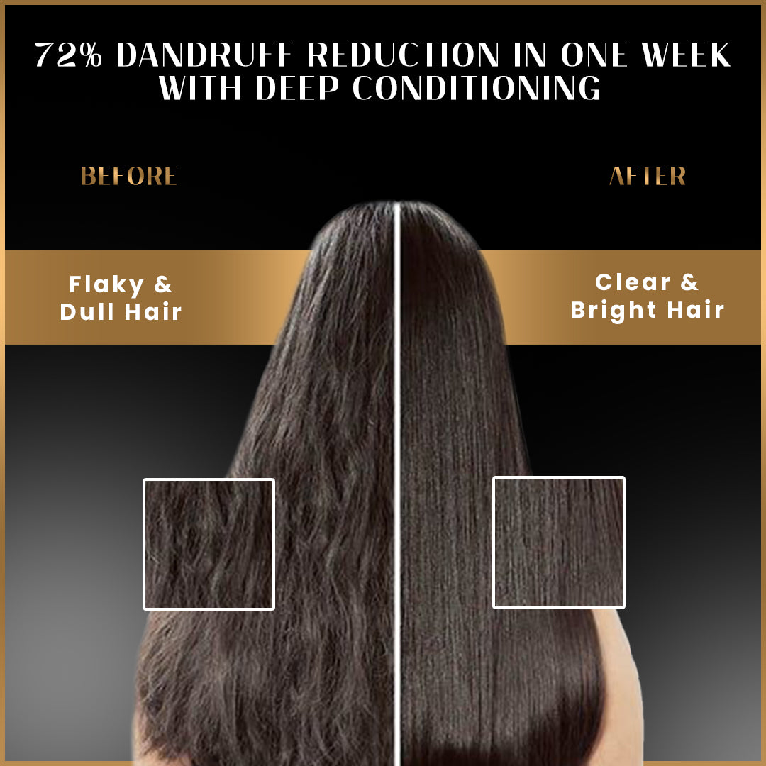 Dandruff Defense Kit with Shampoo, Conditioner & Hair Mask Pack of 3