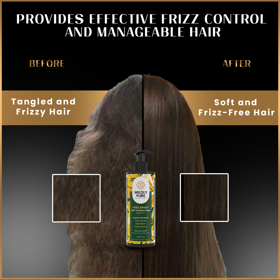 Free Spirit Anti Frizz Shampoo with Omega 3, 6, 9 for Nourishment & moisturization |150mL