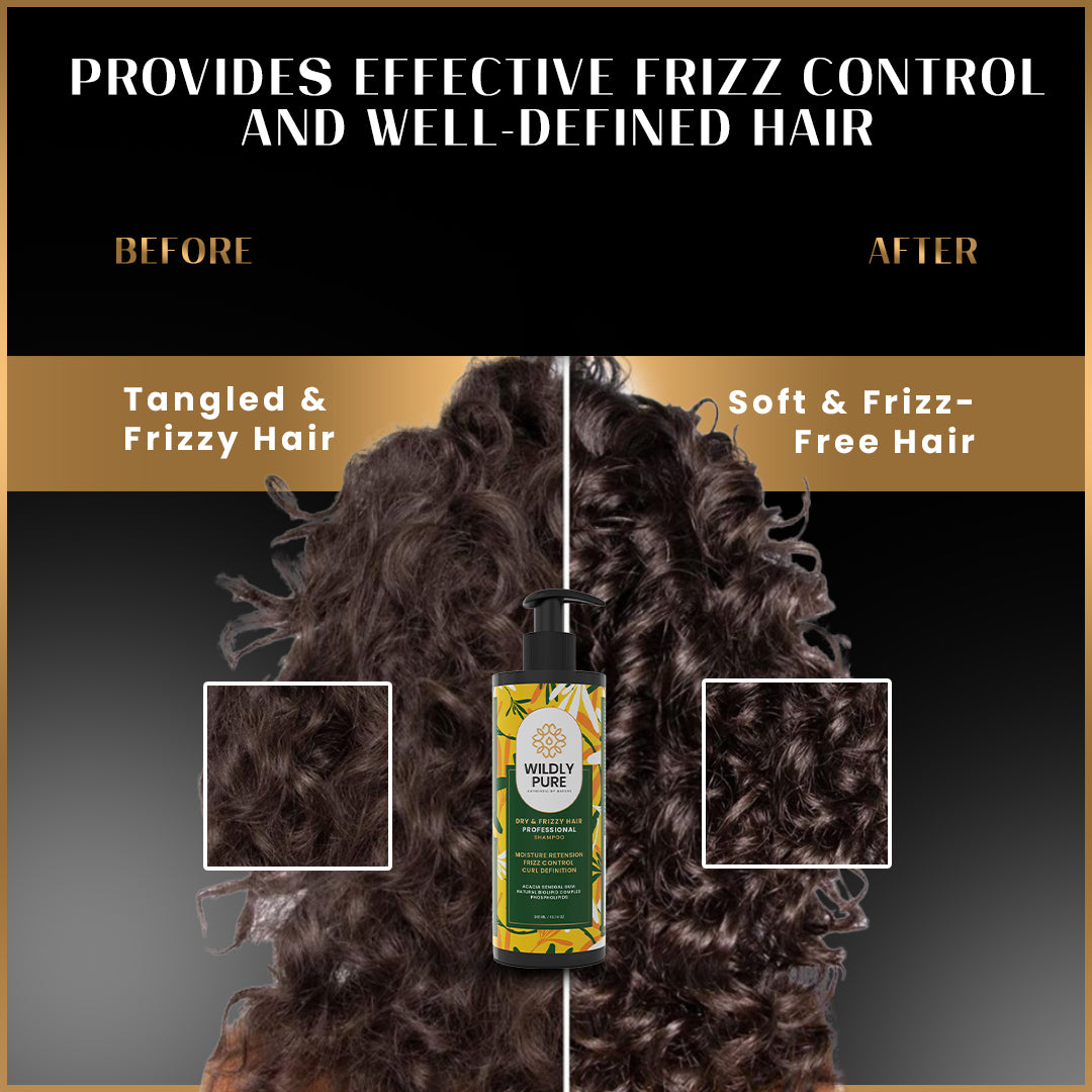 Free Spirit Anti Frizz Shampoo with Omega 3, 6, 9 for Nourishment & moisturization |300mL
