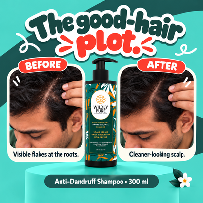 Calm Professional Anti-Dandruff Shampoo – Flakes, Itching & Oily Scalp Care | 300 ml
