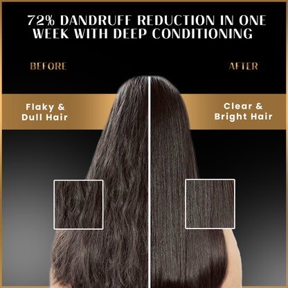 Dandruff Control Shampoo and Mask Combo with Hyaluronic Acid & Piroctone Olamine 300ml + 200mL
